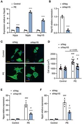 NAP1L5 Promotes Nucleolar Hypertrophy and Is Required for Translation Activation During Cardiomyocyte Hypertrophy